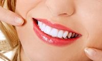 قیمت لمینت دندان در سال 1403 | هزینه لمینت هر واحد دندان