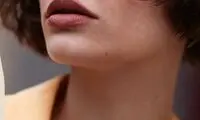 چگونه می‌توان رشد موهای زیر چانه را متوقف کرد؟