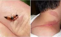 دراکولاها به چه کسانی حمله می‌کنند؟