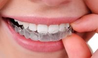 ارتودنسی بدون سیم چیست؟ | هزینه، مزایا، معایب ارتودنسی نامرئی