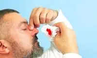 راه‌های برخورد با خونریزی بینی 