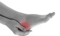 همه چیز درباره علائم و بیماری «خار پاشنه»