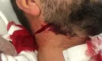 دو تصویر از جراحت وحشتناک روحانی خبرساز