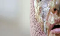 تصاویر هولناک از اسیدپاشی به مرد جوان