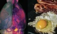 این نوع رژیم غذایی مغز را کوچک می‌کند
