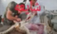ماجرای تصویر کالبدشکافی که گفتند برای پیروز است