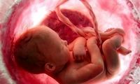 جنجال دوباره ارتباط استامینوفن با اتیسم