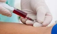 خانم‌ها اگر این علائم را دارید حتما آزمایش دهید