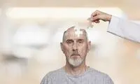 یک فرآیند طبیعی که از آلزایمر پیشگیری می‌کند