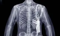 تصاوير پرتو ايكس از درون پديده‌ های پيش رو