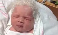 بچه هایی که با سر پرمو به دنیا آمدند!