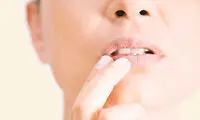 آفت دهان؛ دردناک و شایع اما بی‌خطر