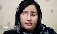 ابهام در ختم پرونده قربانیان اسیدپاشی اصفهان