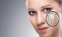 دشمنان پوست؛ از دیر خوابیدن تا نخوردن آب کافی