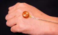تشخیص غیرتهاجمی اختلالات پوست با ابزار حسی