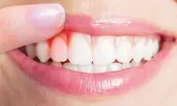 اطلاعات علمی جدید و مفید درباره جراحی لثه و کاشت دندان