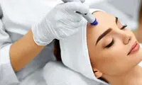 مزونیدلینگ؛ روش جدید جوان‌سازی پوست