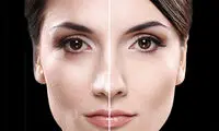 اگر پوست چرب دارید، بخوانید