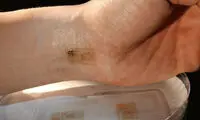 پوستی از جنس طلا +عکس