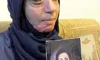 قصاص چشم در انتظار پدر شوهر اسيدپاش