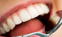 5 راهکار ساده برای داشتن دندان‌های سالم