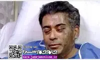 عکس پزشک قربانی اسیدپاشی پس از حادثه