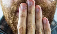 مردی که بعد از ۳۴ سال آروغ زد!