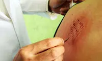 جراحی به روش بوعلی سینا!