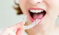 ارتودنسی نامرئی؛ مزایا و قیمت آن