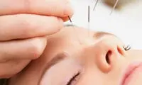 رواج طب چینی در کلینیک‌های زیبایی ایرانی