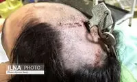 تصویری از تنبیه وحشتناک دختر ۶‌ساله در قزوین