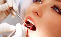 پروتز دندان چیست و چه انواعی دارد؟ 