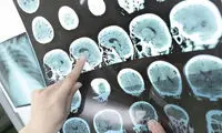 استفاده از هوش مصنوعی برای رمزگشایی مغز