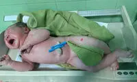 نوزاد پنج کیلوگرمی در بیجار متولد شد