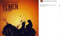 پست «مسعود ده‌نمکی» برای کودکان یمنی
