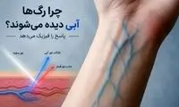 چرا رگ‌ها آبی دیده می‌شوند؟ پاسخ را فیزیک می‌دهد