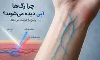 چرا رگ‌ها آبی دیده می‌شوند؟ پاسخ را فیزیک می‌دهد