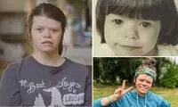 این زن ۲۷ ساله هر کسی را می‌بیند، عاشقش می‌شود