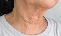 چروک گردن را با این ۳ راهکار محو کنید