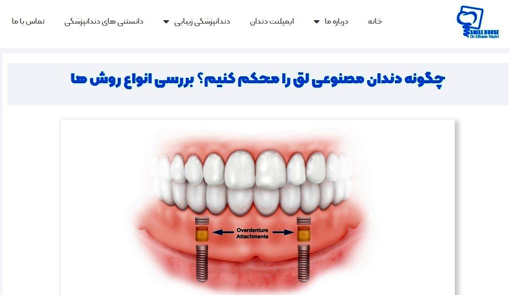 برای جا افتادن دندان مصنوعی چه کنیم؟ معرفی 3 روش کاربردی 