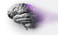 این علائم یعنی به زوال عقل دچار شده‌اید!