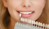 بررسی کامل مزایا و معایب لمینت دندان