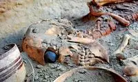 کهن‌ترین پروتز جهان در «قوطی کبریت» نگهداری می‌شود!