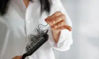 برای جلوگیری از ریزش مو باید چه کاری انجام دهید؟