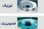 خداحافظی با عینک با عمل فمتولیزیک توسط دکتر محمدخانی 