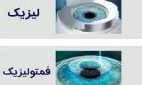 خداحافظی با عینک با عمل فمتولیزیک توسط دکتر محمدخانی 