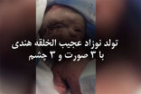 تولد نوزاد عجیب الخلقه هندی با 3 صورت و 3 چشم