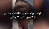 تولد نوزاد عجیب الخلقه هندی با 3 صورت و 3 چشم