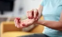خارش کف دست خبر از پول می‌دهد یا بیماری؟