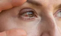 دلایل پارگی رگ خونی در چشم؛ چه موقع به پزشک مراجعه کنیم؟